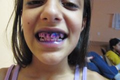 20150422_kliny_044